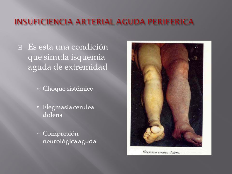 INSUFICIENCIA ARTERIAL PERIFERICA EBOOK DOWNLOAD INSUFICIENCIA ARTERIAL PERIFERICA EBOOK DOWNLOAD